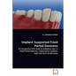 Implant Supported Fixed Partial Dentures - Paperback