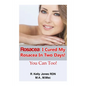 Rosacea: I Cured My Rosacea In Two Days! You Can Too! - Paperback
