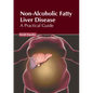 Non-Alcoholic Fatty Liver Disease: A Practical Guide - Hardcover