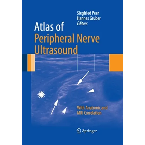 Atlas of Peripheral Nerve Ultrasound: With Anatomic and MRI Correlation - Paperback