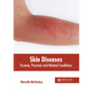Skin Diseases: Eczema, Psoriasis and Related Conditions - Hardcover