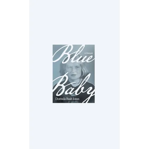 Blue Baby: A Memoir - Hardcover