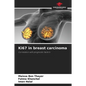 Ki67 in breast carcinoma - Paperback