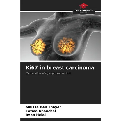 Ki67 in breast carcinoma - Paperback
