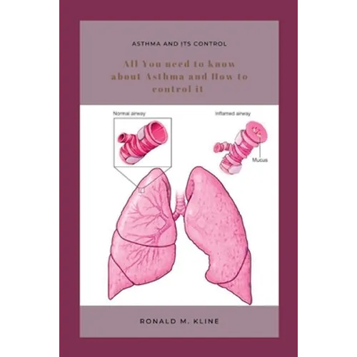 Asthma and its control: All you need to know about Asthma and how to control it. - Paperback