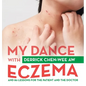 My Dance with Eczema: And 80 Lessons for the Patient and the Doctor - Hardcover