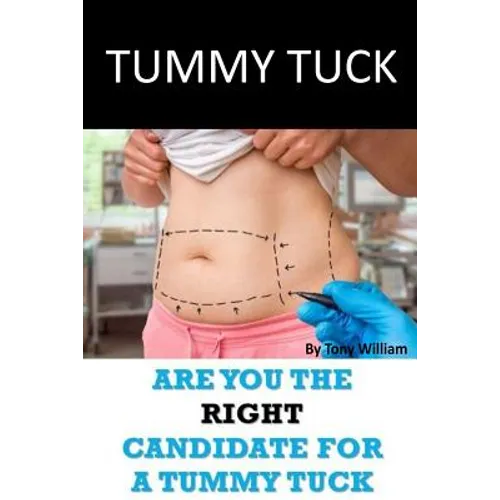 Tummy Tuck: Are You The Right Candidate For A Tummy Tuck - Paperback