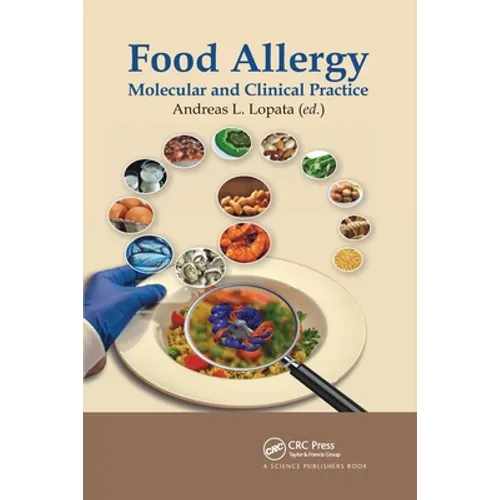 Food Allergy: Molecular and Clinical Practice - Paperback