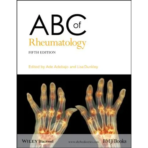ABC of Rheumatology - Paperback