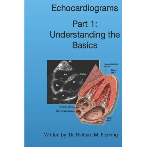 Echocardiograms - Part 1: Understanding the Basics. - Paperback