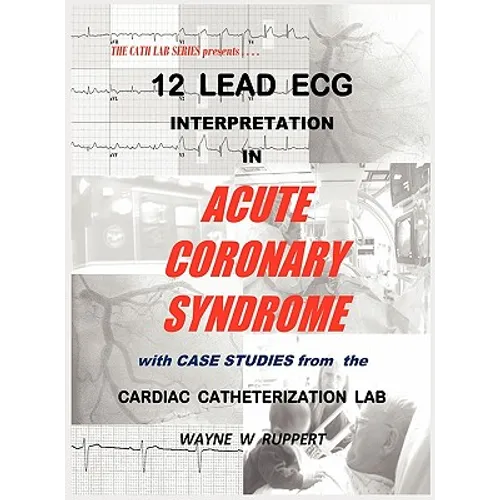 12 Lead ECG Interpretation in Acute Coronary Syndrome with Case Studies from the Cardiac Catheterization Lab - Hardcover