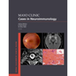 Mayo Clinic Cases in Neuroimmunology - Paperback