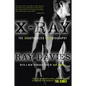 X-Ray: The Unauthorized Autobiography: A Speculative Memoir of the Kinks and the Death of the Sixties - Paperback