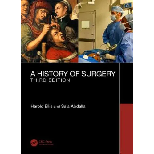 A History of Surgery: Third Edition - Paperback