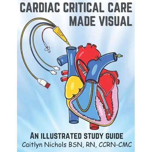 Cardiac Critical Care Made Visual - Paperback