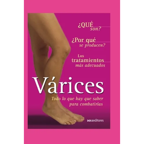 Várices: todo lo que hay que saber para combatirlas - Paperback