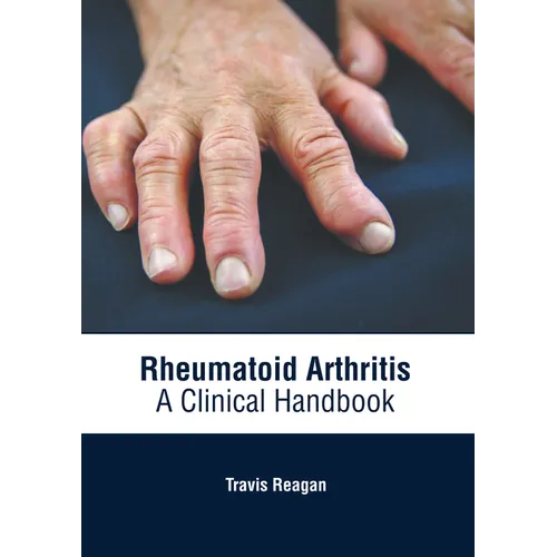 Rheumatoid Arthritis: A Clinical Handbook - Hardcover