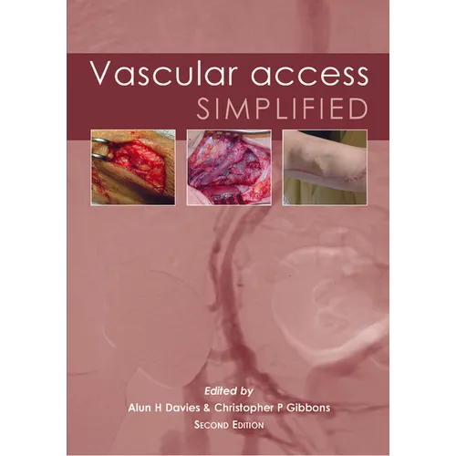 Vascular Access Simplified; Second Edition - Paperback