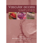 Vascular Access Simplified; Second Edition - Paperback