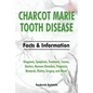 Charcot Marie Tooth Disease: Diagnosis, Symptoms, Treatment, Causes, Doctors, Nervous Disorders, Prognosis, Research, History, Surgery, and More! F - Paperback