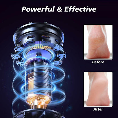 Yreihn Electric Callus Remover for Feet Purple 1 Count ABS Material