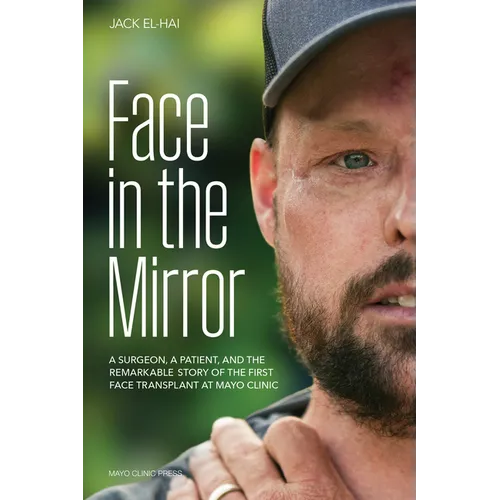 Face in the Mirror: A Surgeon, a Patient, and the Remarkable Story of the First Face Transplant at Mayo Clinic - Hardcover