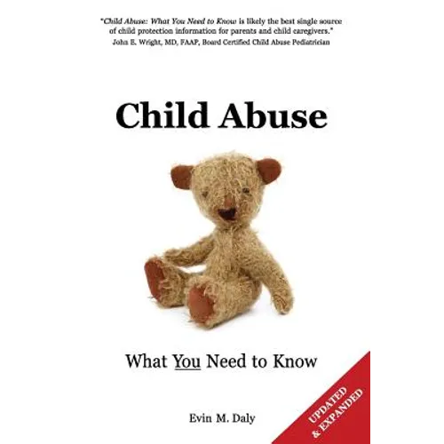 Child Abuse: What You Need to Know - Paperback