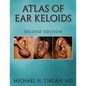 Atlas of Ear Keloids - Second Edition - Paperback