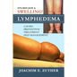 It's Not Just a Swelling! Lymphedema: Causes, Prevention, Treatment, Self-Management - Paperback
