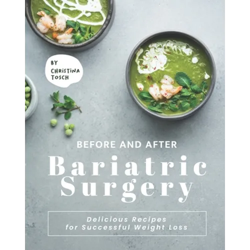 Before and After Bariatric Surgery: Delicious Recipes for Successful Weight Loss - Paperback