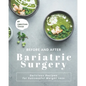 Before and After Bariatric Surgery: Delicious Recipes for Successful Weight Loss - Paperback