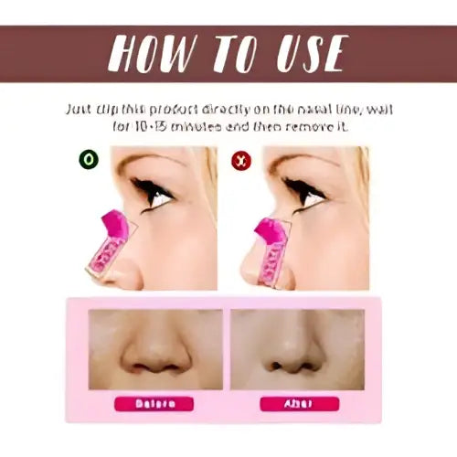 Pink Nose Shaping Device for Correction Nose Contour