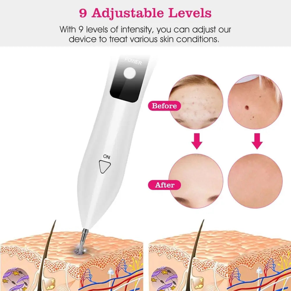 Portable LCD Skin Tag Repair Kit with USB Charging