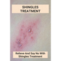 Shingles Treatment: Relieve And Say No With Shingles Treatment: Shingles On Face Treatment - Paperback