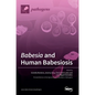 Babesia and Human Babesiosis - Hardcover