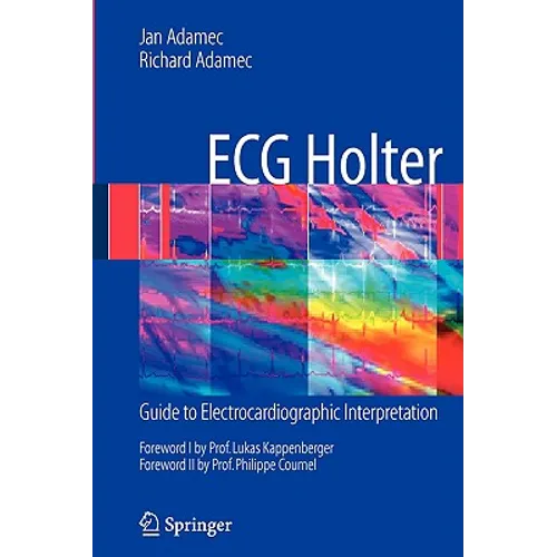 ECG Holter: Guide to Electrocardiographic Interpretation - Paperback