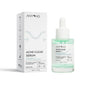 Anyong Acne Clear Serum - Natural Acne Treatment with Centella Asiatica & Azelaic Acid