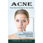 Acne: Proven Natural Remedies for Acne-free Skin (Learn About the Most Recent Updated Natural Acne) - Paperback