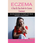 Eczema: A Step By Step Guide for Eczema Treatment (Ayurvedic Remedies Live Healthy With Natural Remedies to Avoid Eczema) - Paperback