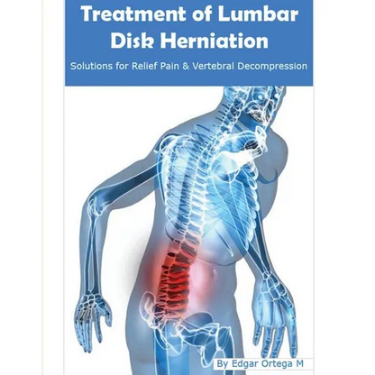 Treatment of Lumbar Disk Herniation: Back Pain Relief and Herniated Discs Solutions - Paperback