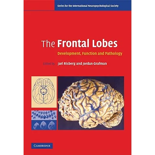 The Frontal Lobes - Paperback