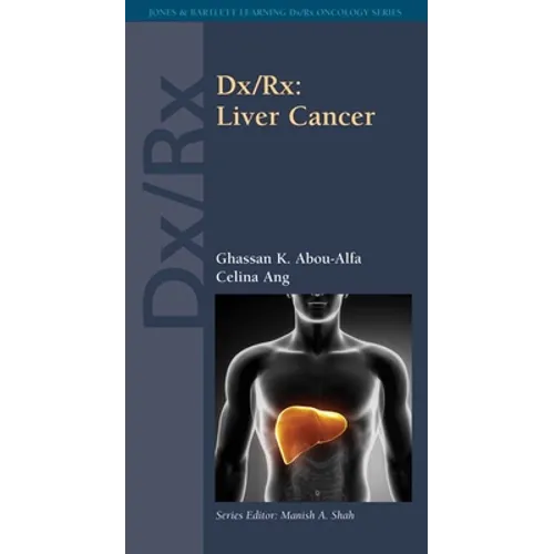DX/Rx: Liver Cancer: Liver Cancer - Paperback