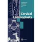 Cervical Laminoplasty - Hardcover