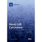 Renal Cell Carcinoma - Hardcover