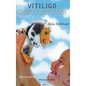 Vitiligo Doesn't Scare Me - Hardcover