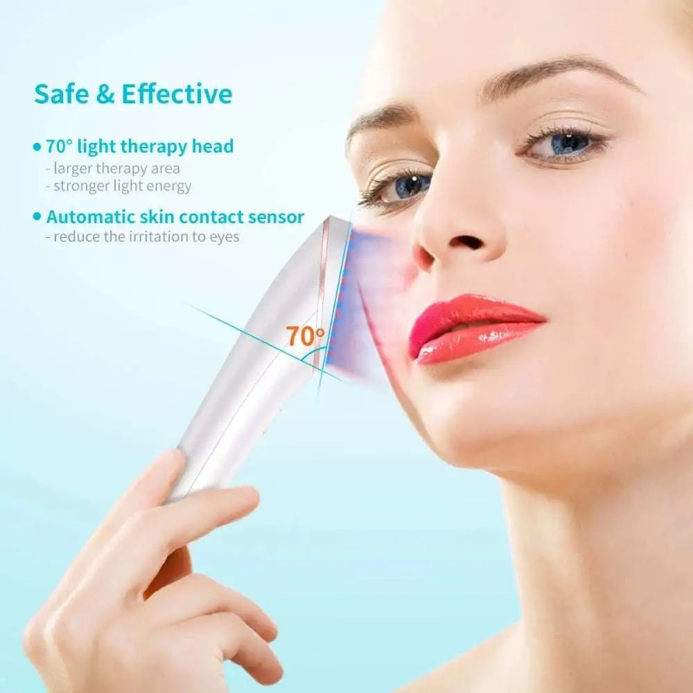 Xpreen Wireless Blue Light Acne Therapy Device
