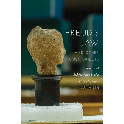 Freud's Jaw and Other Lost Objects: Fractured Subjectivity in the Face of Cancer - Hardcover