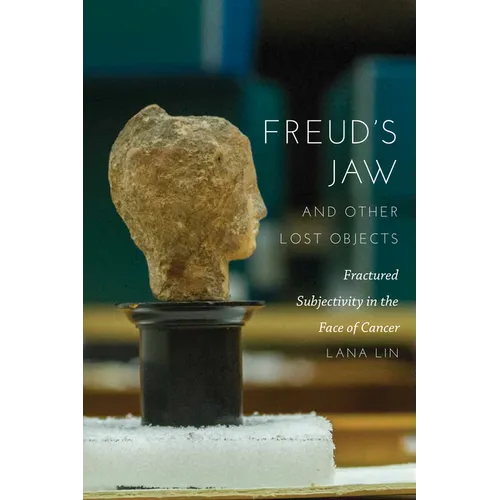 Freud's Jaw and Other Lost Objects: Fractured Subjectivity in the Face of Cancer - Hardcover