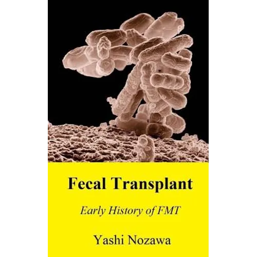 Fecal Transplant: Early History of FMT - Paperback