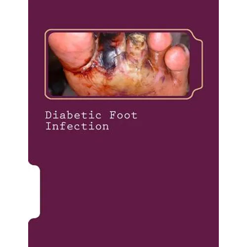 Diabetic Foot Infection - Paperback